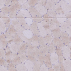 Immunohistochemical staining of human skeletal muscle shows very weak cytoplasmic positivity in myocytes.