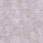 Immunohistochemical staining of human skeletal muscle shows very weak cytoplasmic positivity in myocytes.