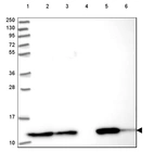 Lane 1: Marker [kDa] 250, 130, 95, 72, 55, 36, 28, 17, 10_br/_Lane 2: Human cell line RT-4_br/_Lane 3: Human cell line U-251 MG_br/_Lane 4: Human plasma_br/_Lane 5: Human Liver tissue_br/_Lane 6: Human Tonsil tissue