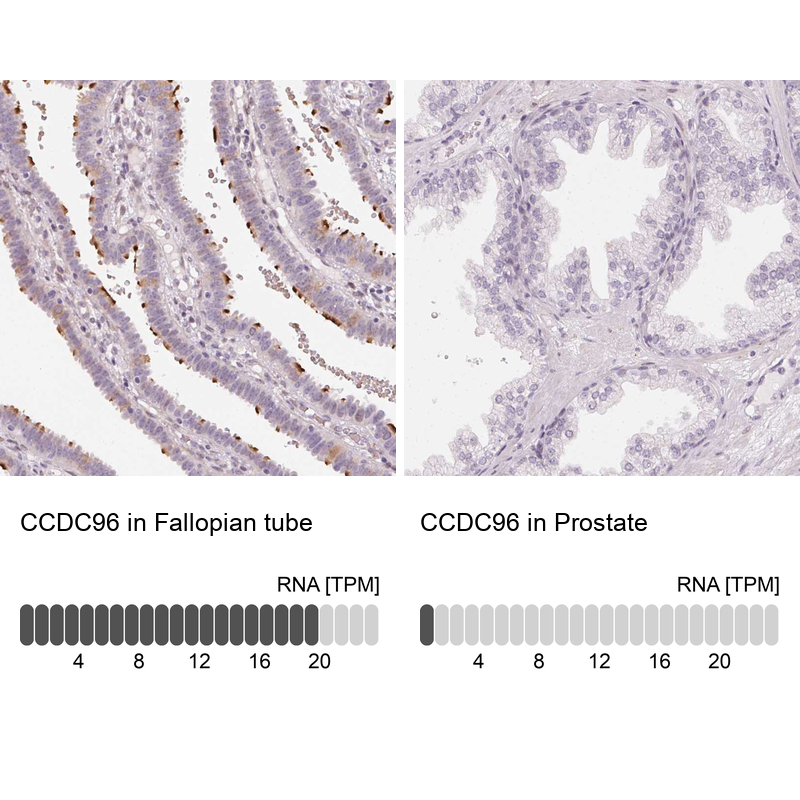 Anti-CCDC96 Antibody
