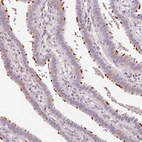 Immunohistochemical staining of human fallopian tube shows high expression.