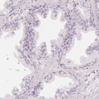 Immunohistochemical staining of human prostate shows low expression as expected.