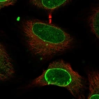 Immunofluorescent staining of human cell line HeLa shows localization to nuclear membrane.