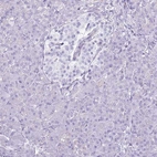 Immunohistochemical staining of human pancreas shows no positivity as expected.