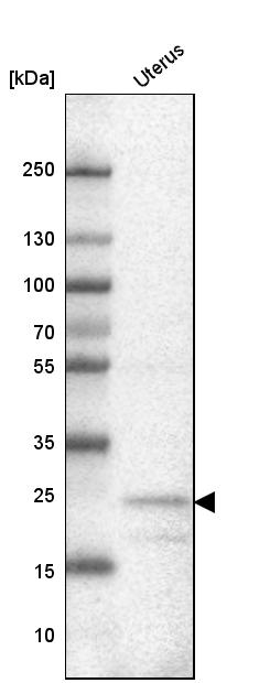 Anti-FBXL22 Antibody
