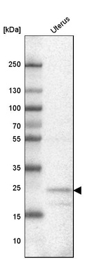 Anti-FBXL22 Antibody
