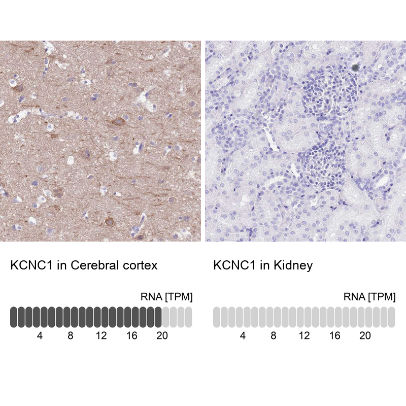 Anti-KCNC1 Antibody