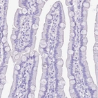 Immunohistochemical staining of human small intestine shows no positivity in glandular cells as expected.