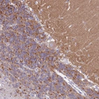 Immunohistochemical staining of human cerebellum shows moderate to strong cytoplasmic positivity in granular layer.
