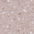 Immunohistochemical staining of human cerebral cortex shows weak to moderate cytoplasmic positivity in neurons.