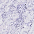 Immunohistochemical staining of human kidney shows no positivity in cells in tubules as expected.