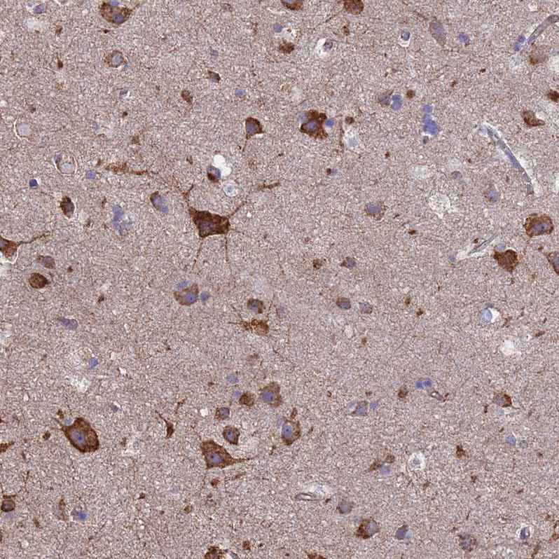 Anti-PYCR1 Antibody