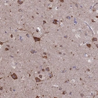 Anti-PYCR1 Antibody