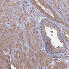 Immunohistochemical staining of human prostate shows moderate cytoplasmic positivity in smooth muscle cells.