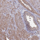 Immunohistochemical staining of human prostate shows moderate cytoplasmic positivity in smooth muscle cells.