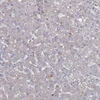 Immunohistochemical staining of human liver shows low positivity in hepatocytes as expected.