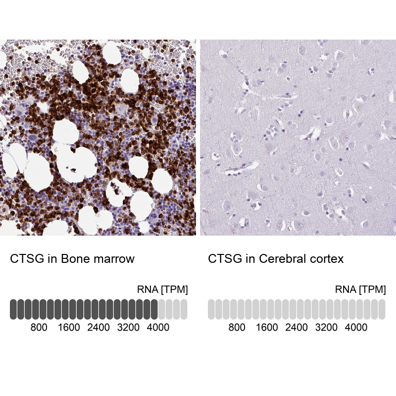 Anti-CTSG Antibody