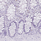 Immunohistochemical staining of human rectum shows no positivity in glandular cells as expected.