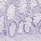 Immunohistochemical staining of human rectum shows no positivity in glandular cells as expected.