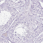 Immunohistochemical staining of human testis shows no positivity in cells in seminiferous ducts as expected.