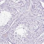 Immunohistochemical staining of human testis shows no positivity in cells in seminiferous ducts as expected.