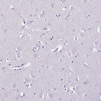 Immunohistochemical staining of human cerebral cortex shows no positivity in neurons as expected.