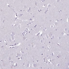 Immunohistochemical staining of human cerebral cortex shows no positivity in neurons as expected.