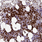 Immunohistochemical staining of human bone marrow shows strong cytoplasmic positivity in hematopoietic cells.