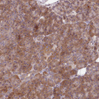 Anti-WASHC2A Antibody