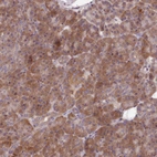 Immunohistochemical staining of human pancreas shows strong cytoplasmic positivity in exocrine glandular cells.