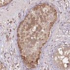 Immunohistochemical staining of human testis shows strong cytoplasmic positivity in cells in seminiferous ducts.