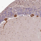 Immunohistochemical staining of human cerebellum shows strong cytoplasmic positivity in Purkinje cells.