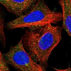 Immunofluorescent staining of human cell line U-2 OS shows localization to nucleoli, cytosol & vesicles.
