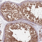 Immunohistochemical staining of human testis shows strong cytoplasmic positivity in cells in seminiferous ducts.