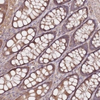 Immunohistochemical staining of human colon shows moderate cytoplasmic positivity in glandular cells.