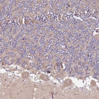Immunohistochemical staining of human cerebellum shows moderate cytoplasmic positivity in Purkinje cells.