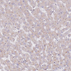 Immunohistochemical staining of human liver shows negative cytoplasmic positivity in hepatocytes as expected.