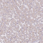 Immunohistochemical staining of human liver shows negative cytoplasmic positivity in hepatocytes as expected.