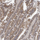 Anti-COL5A3 Antibody