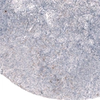 Immunohistochemical staining of human tonsil shows moderate cytoplasmic positivity in lymphoid cells.