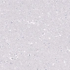 Immunohistochemical staining of human cerebral cortex shows no cytoplasmic positivity in neuropil as expected.