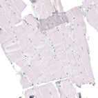 Immunohistochemical staining of human skeletal muscle shows no positivity in myocytes as expected.