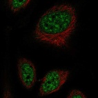Anti-RFPL2 Antibody