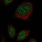 Anti-RFPL2 Antibody