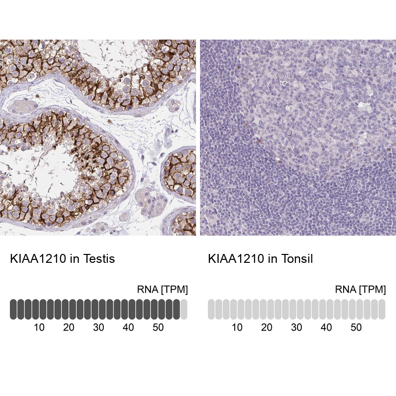 Anti-KIAA1210 Antibody