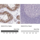 Anti-KIAA1210 Antibody