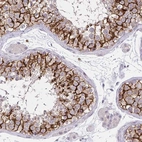 Immunohistochemical staining of human testis shows high expression.