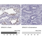 Anti-SPACA7 Antibody