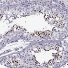 Immunohistochemical staining of human testis shows high expression.