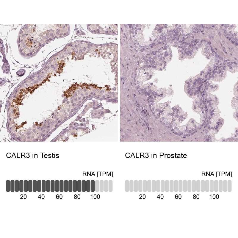 Anti-CALR3 Antibody